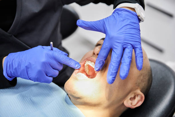 Best Emergency Treatment for Toothache in Menands, NY